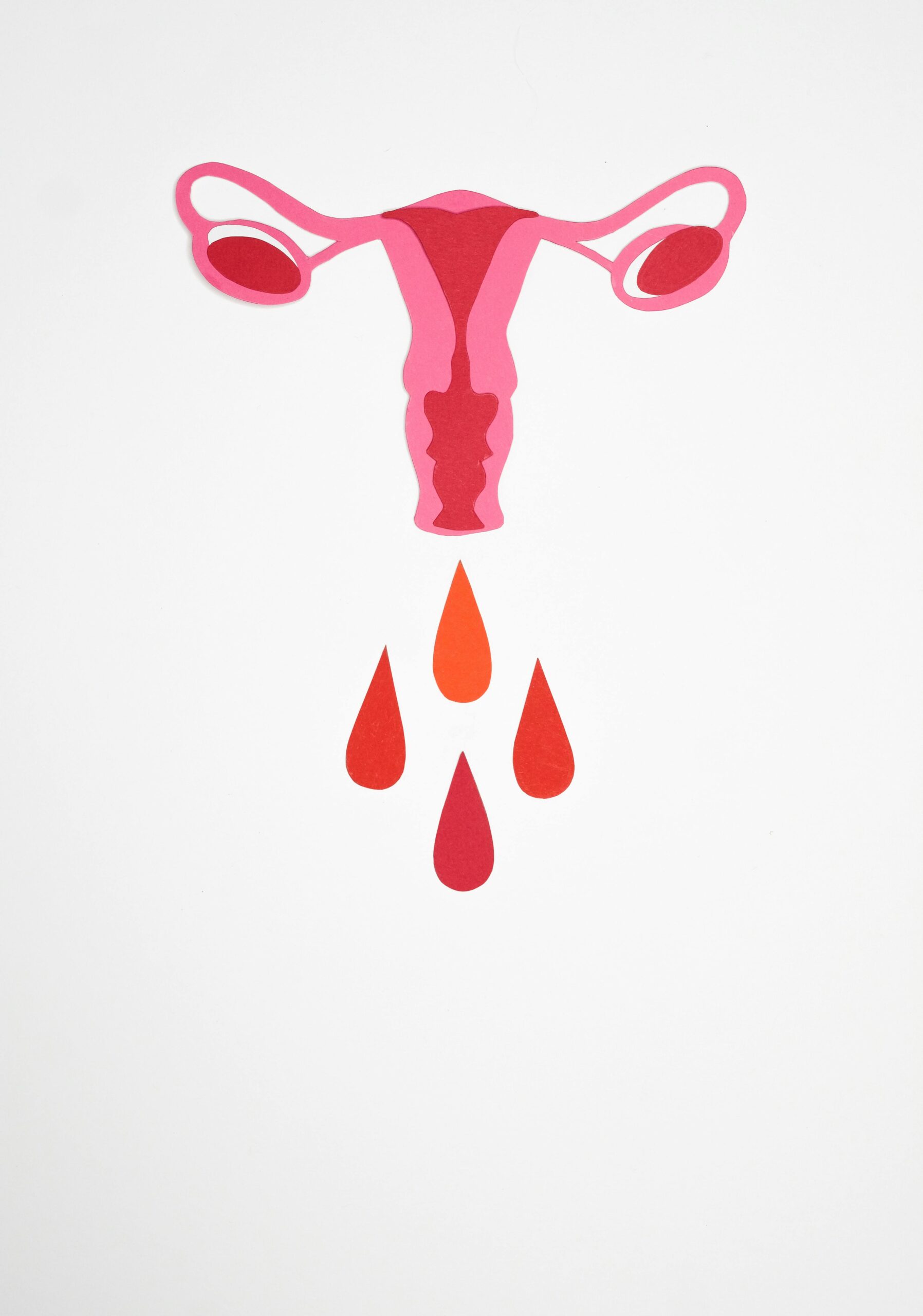 Missing Your Period for 3 Months or More? Here’s What Hypothalamic Amenorrhea Means for Your Health…