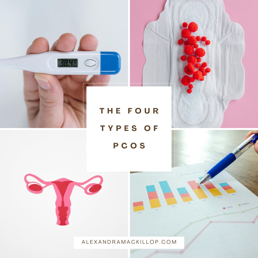 Are There Different Types of PCOS? Understand Your Diagnosis and More