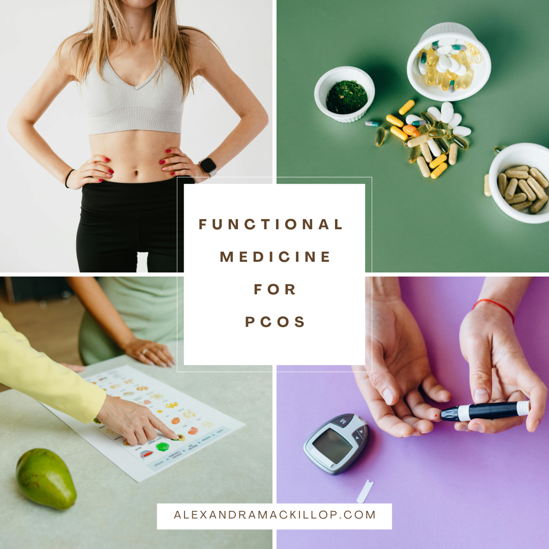 Treating Polycystic Ovarian Syndrome with Functional Medicine